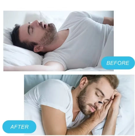 Dilatateurs de respiration nasale