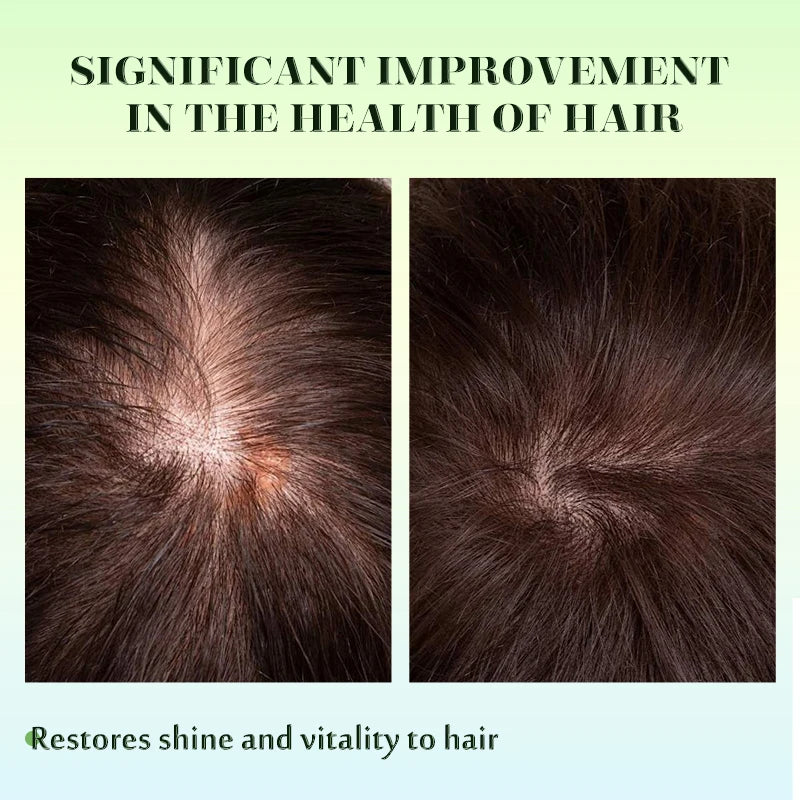 Huile de menthe de romarin pour renforcer les cheveux du cuir chevelu, traitement nourrissant essentiel pour la croissance des cheveux, pour pointes fourchues, huile de soin pour cheveux organiques secs