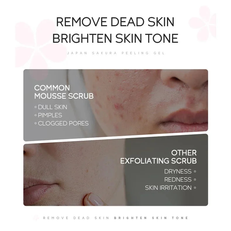 LAIKOU Sakura Peeling Gel Exfoliation du visage nettoie les Pores hydratant contrôle de l'huile 60g