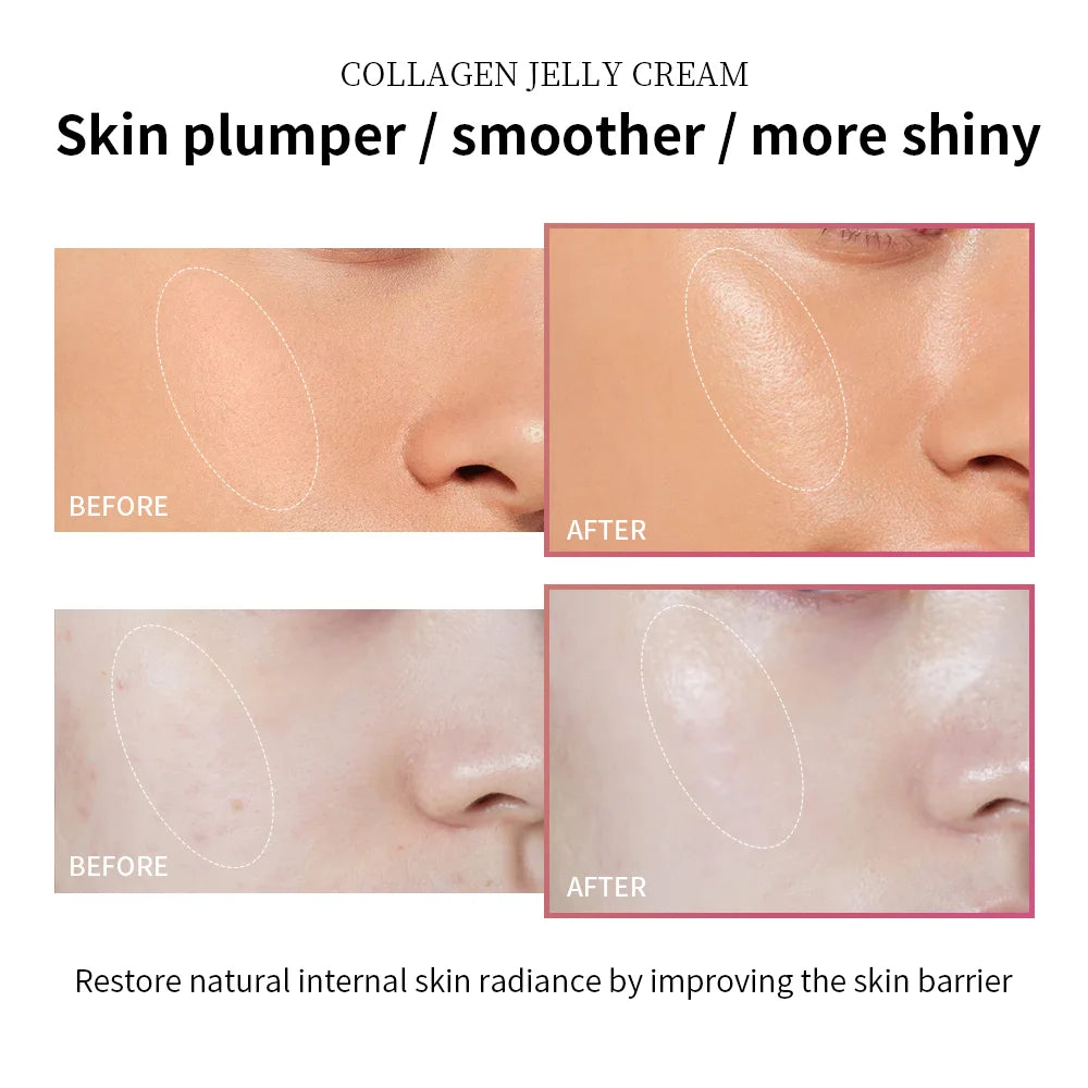 Crème hydratante à la gelée de collagène, Niacinamide, collagène hydrolysé, raffermissant, apaisant, Anti-âge, fermeté, hydratation, soins pour la peau