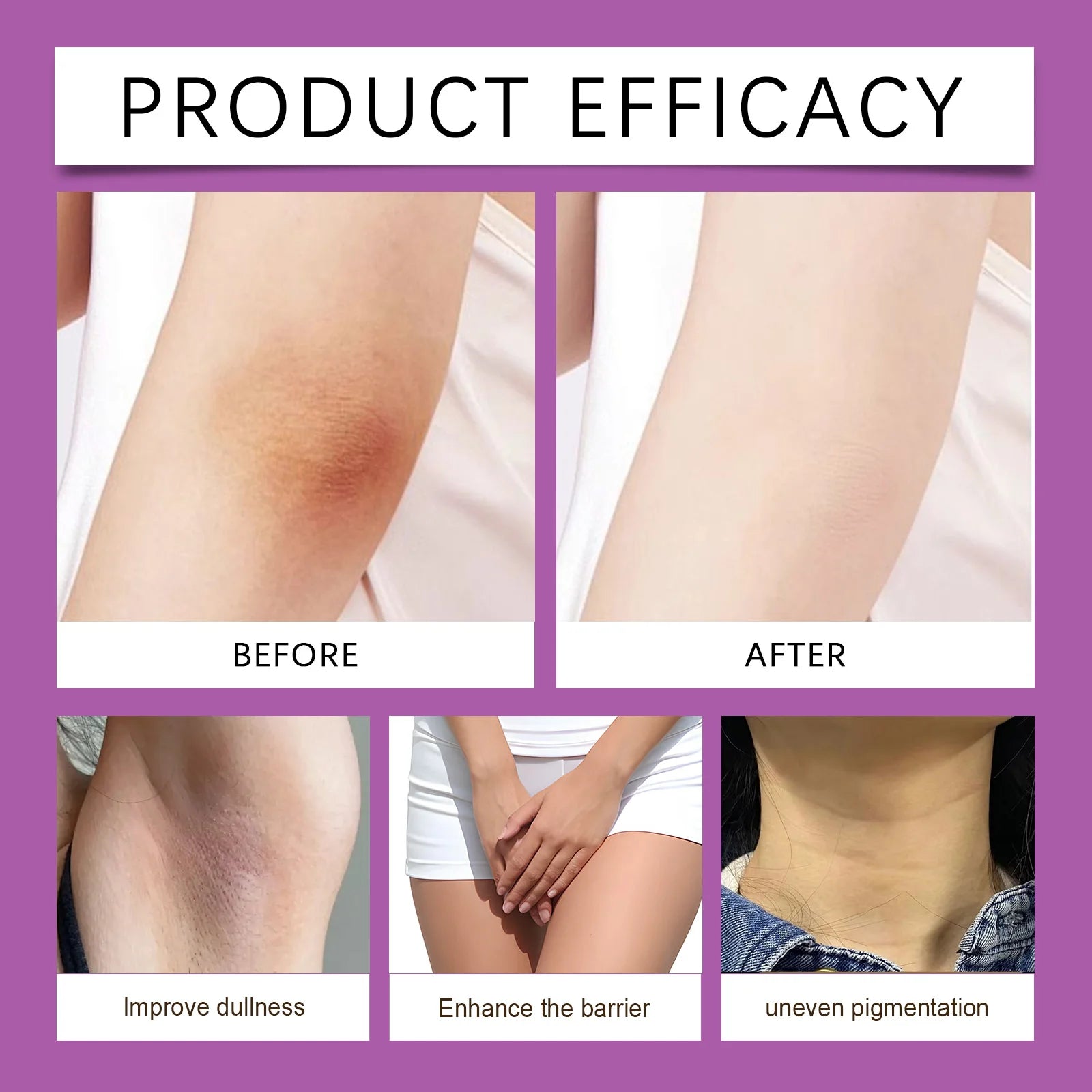 Crème blanchissante pour le corps 50g, blanchiment des parties intimes féminines, soin rafraîchissant, soin quotidien, crème blanchissante pour les aisselles