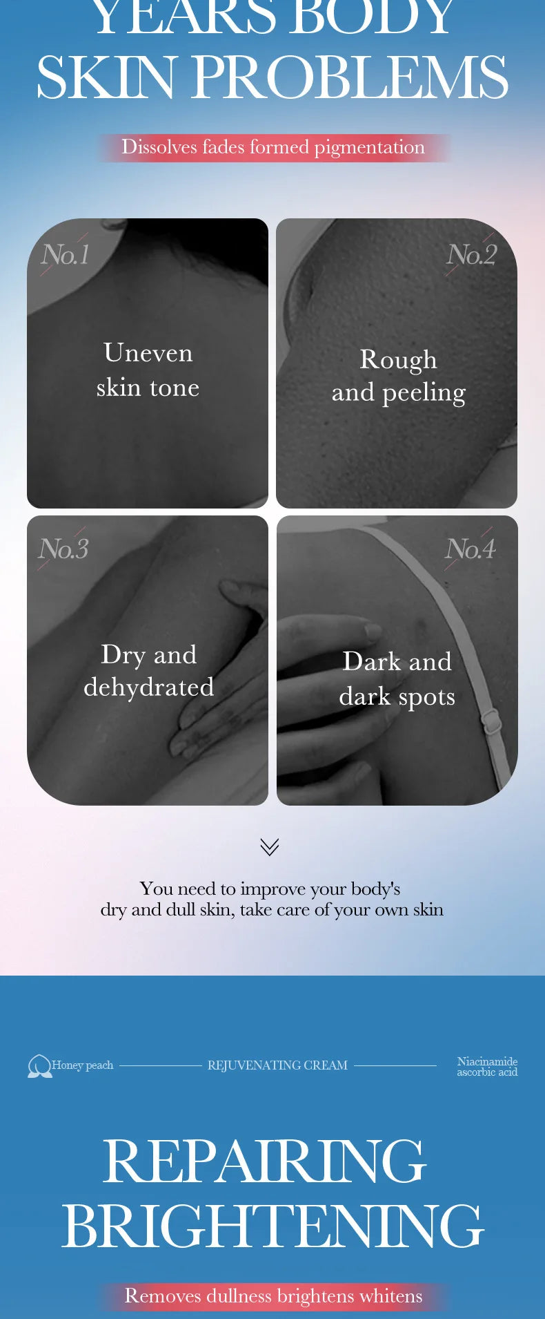 Crème blanchissante parties intimes aisselles fesses genou blanchir l'intérieur des cuisses parties intimes foncé enlever la mélanine femme éclaircir soins de la peau