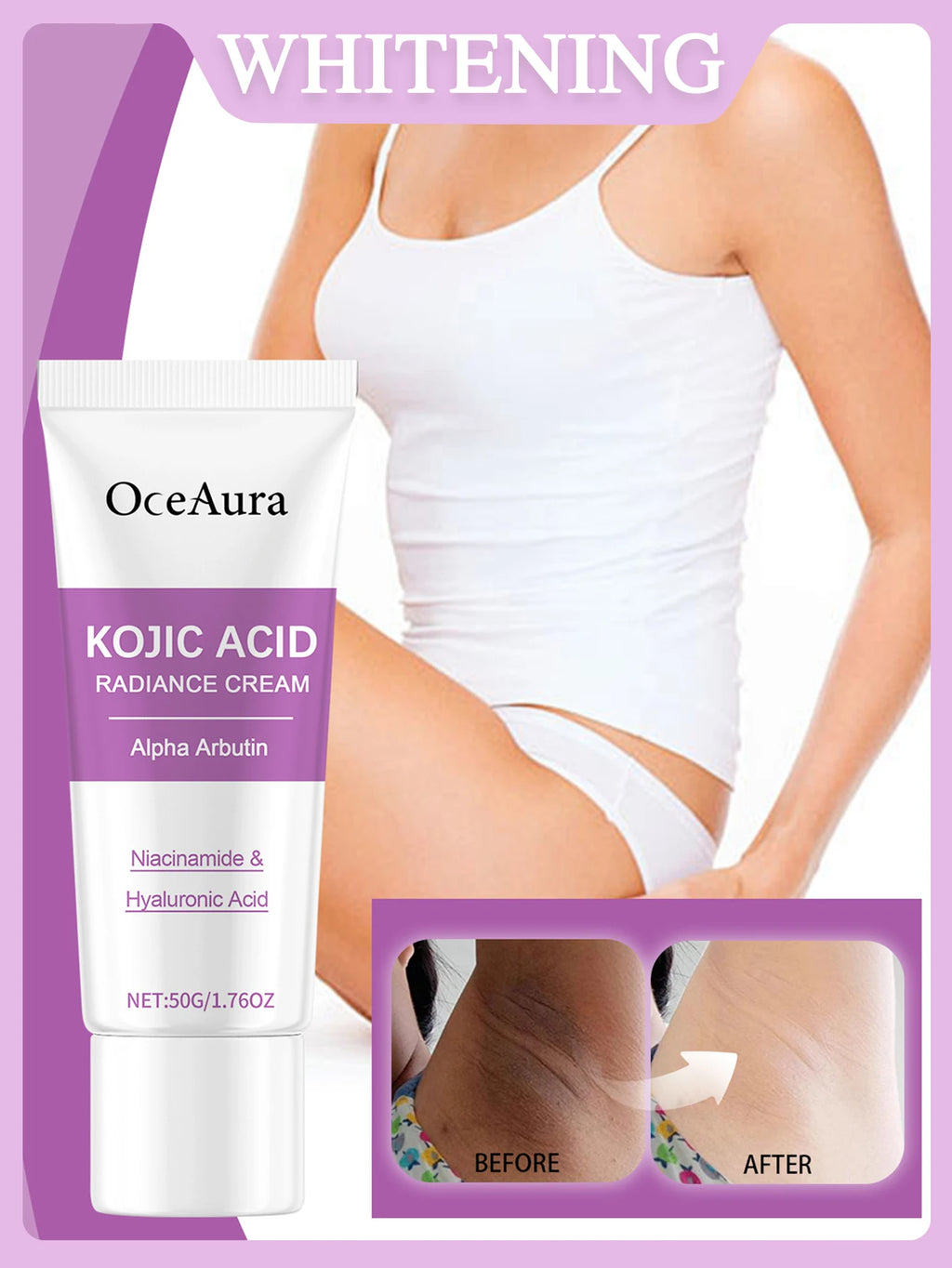 Crème blanchissante pour le corps 50g, blanchiment des parties intimes féminines, soin rafraîchissant, soin quotidien, crème blanchissante pour les aisselles