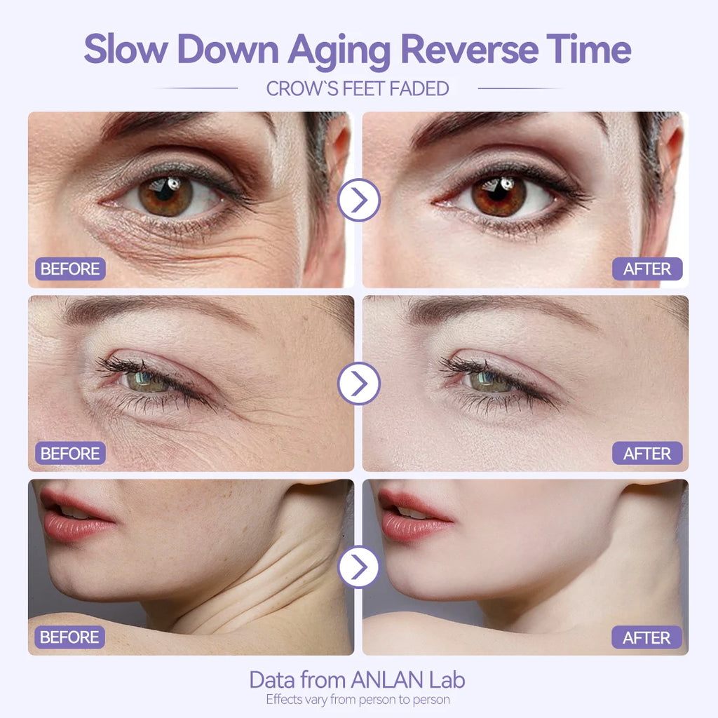 ANLAN EMS masseur Facial Lifting du visage LED Photon nettoyage en profondeur yeux peau rides suppression chaleur Vibration soins de la peau dispositif de beauté