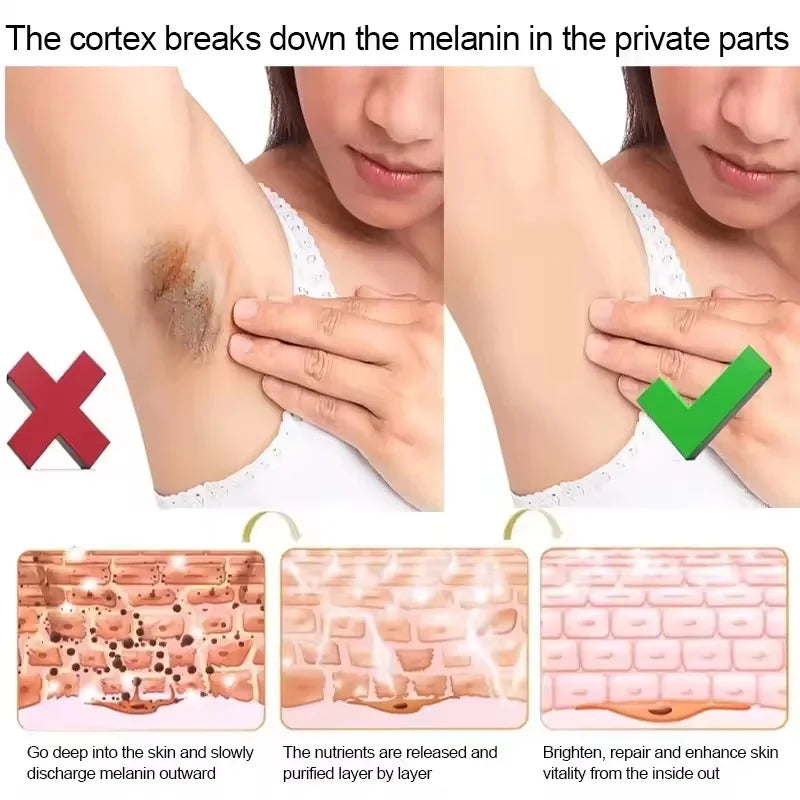 Crème blanchissante parties intimes aisselles fesses genou blanchir l'intérieur des cuisses parties intimes foncé enlever la mélanine femme éclaircir soins de la peau