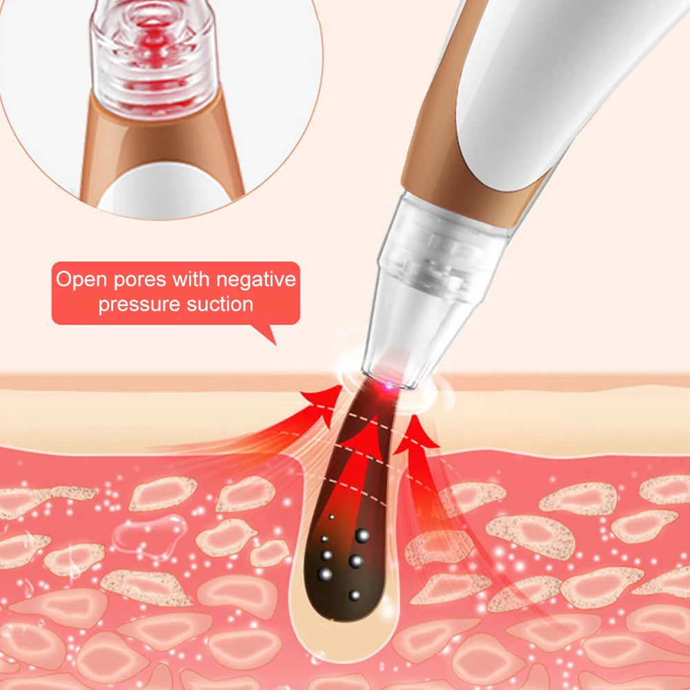 Dissolvant électrique de points noirs et nettoyeur de pores, dispositif Facial de traitement de l'acné avec raffermissement de la peau pour un nettoyage en profondeur des outils de soins de la peau