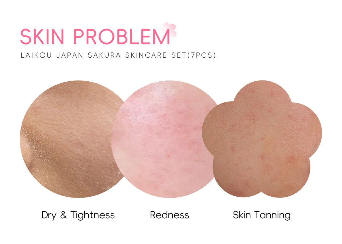 LAIKOU nettoyage Laikou hydratation hydratante japon fleur de cerisier soin de la peau 7 pièces masque de boue édition ensemble de soins du visage