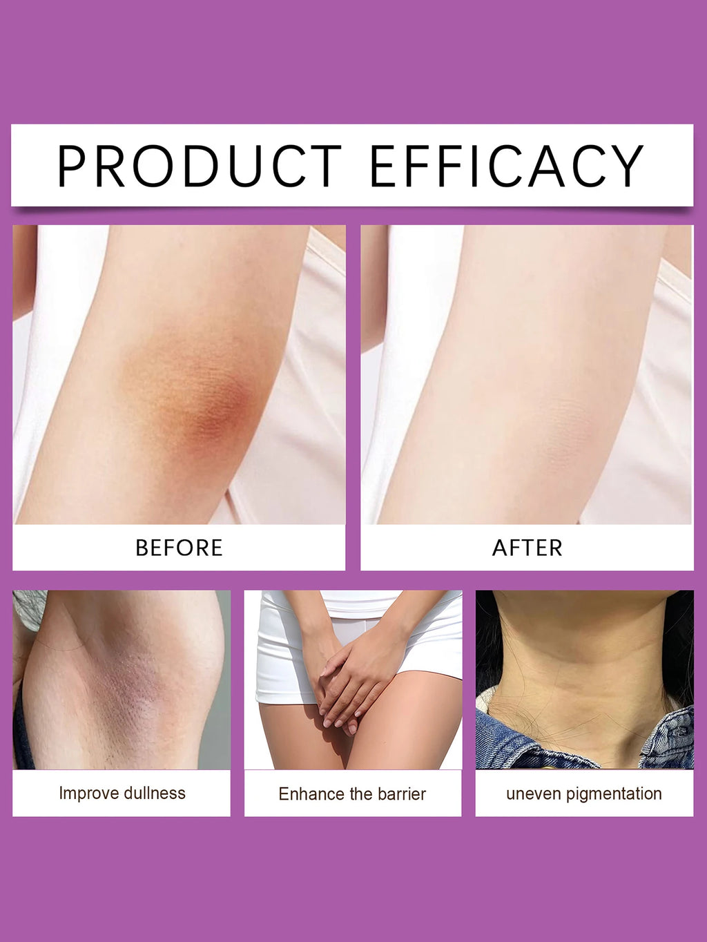 Crème blanchissante pour le corps 50g, blanchiment des parties intimes féminines, soin rafraîchissant, soin quotidien, crème blanchissante pour les aisselles