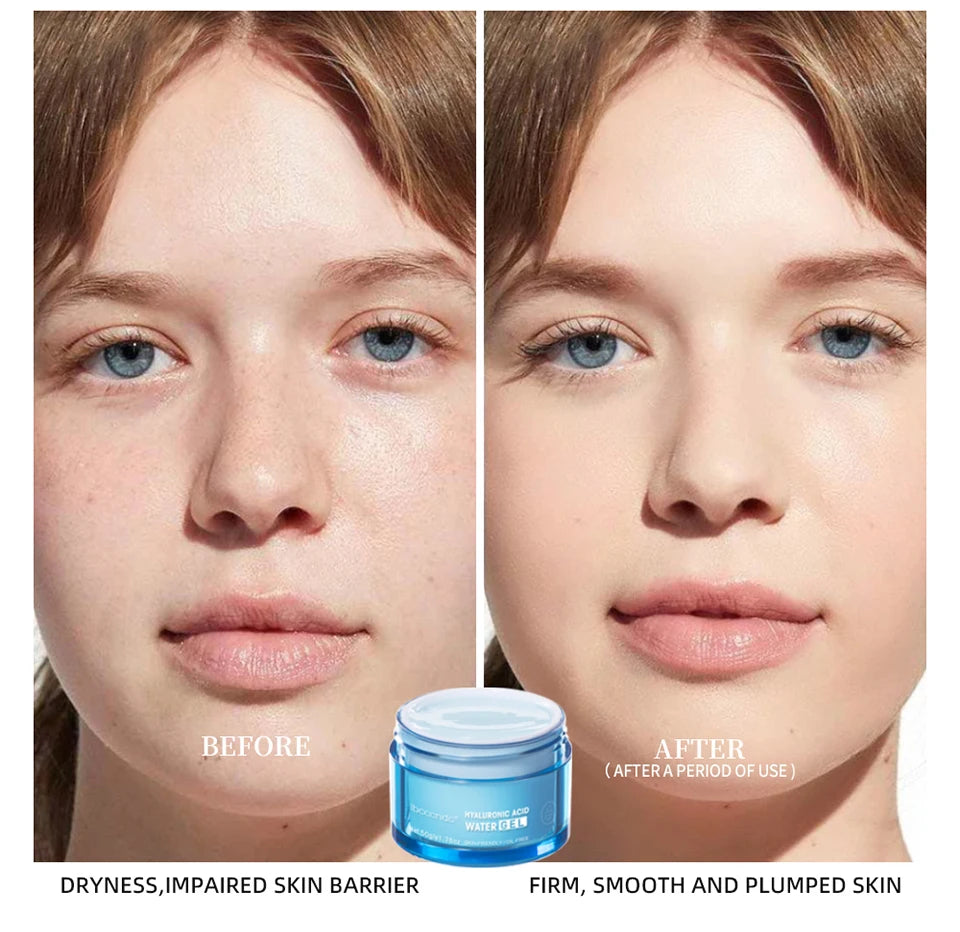 Crème Gel à l'acide hyaluronique, hydratante pour le visage, pour hydrate et lisse, peau Extra sèche, nourrissante, améliore la sécheresse, Lotion pour le visage