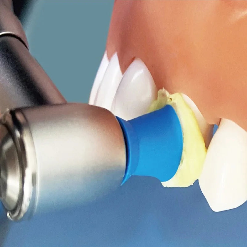 Pâte de prophylaxie dentaire à grain fin et régulier, 40g, pâte de prophylaxie à grain régulier, Implant Ortho, matériel de blanchiment des dents pour dentiste